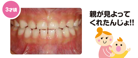 3-year-old2
