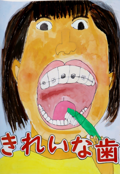 金　賞