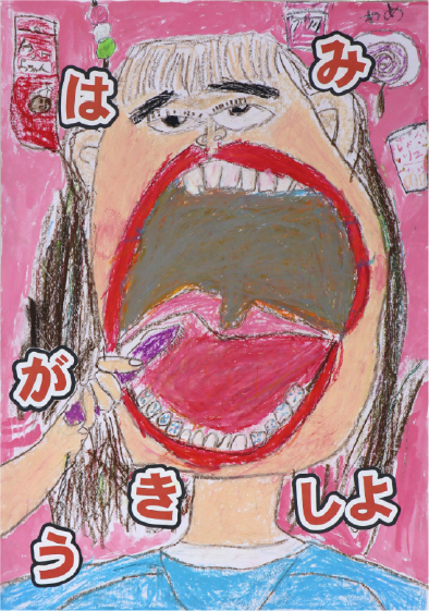 佳作