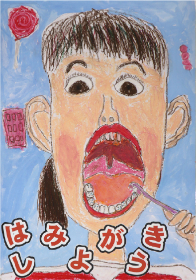 佳作