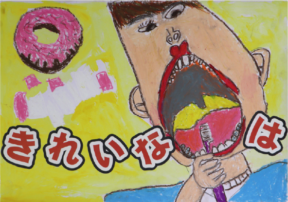 佳作