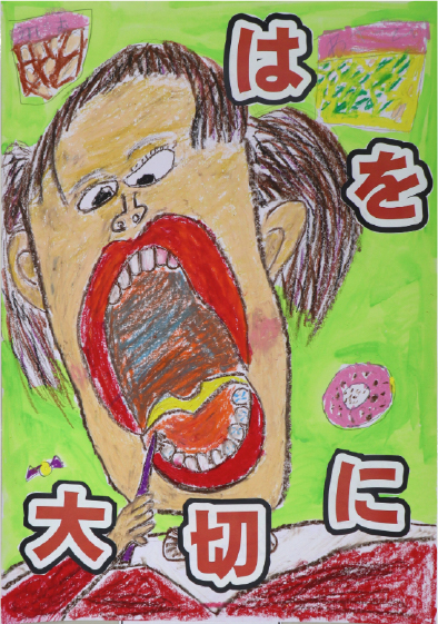 銀賞