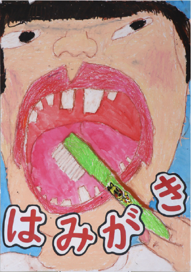 銅賞
