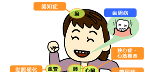 第2回 歯周病と心臓病の関係